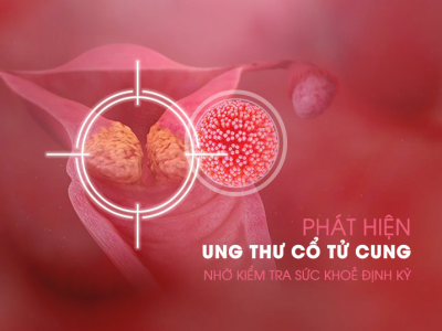 DẤU HIỆU NÀO NHẬN BIẾT UNG THƯ CỔ TỬ CUNG